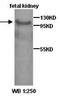 USO1 Vesicle Transport Factor antibody, orb76926, Biorbyt, Western Blot image 