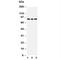 Phosphoinositide-3-Kinase Regulatory Subunit 2 antibody, R30765, NSJ Bioreagents, Western Blot image 