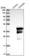 Coiled-Coil Domain Containing 59 antibody, NBP1-88368, Novus Biologicals, Western Blot image 