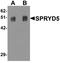 Tripartite Motif-Containing 51 antibody, NBP1-77087, Novus Biologicals, Western Blot image 