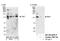 Trimethylguanosine Synthase 1 antibody, NB100-2595, Novus Biologicals, Western Blot image 