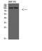 Phosphatidylinositol 3-Kinase Catalytic Subunit Type 3 antibody, STJ98590, St John