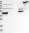 SWI/SNF Related, Matrix Associated, Actin Dependent Regulator Of Chromatin, Subfamily A, Member 2 antibody, NBP1-90015, Novus Biologicals, Western Blot image 