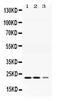 Adenylate kinase isoenzyme 1 antibody, LS-C662317, Lifespan Biosciences, Western Blot image 