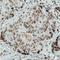 CCCTC-Binding Factor antibody, NBP2-52911, Novus Biologicals, Immunohistochemistry frozen image 