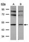 AP2M1 antibody, NBP1-32272, Novus Biologicals, Western Blot image 