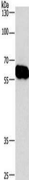 Coronin 1C antibody, TA349821, Origene, Western Blot image 