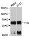 Testin LIM Domain Protein antibody, A4613, ABclonal Technology, Western Blot image 