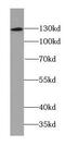 Neuropilin 1 antibody, FNab05680, FineTest, Western Blot image 