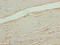 Calcium Voltage-Gated Channel Auxiliary Subunit Alpha2delta 1 antibody, LS-C369348, Lifespan Biosciences, Immunohistochemistry paraffin image 