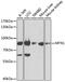 Mitofusin 1 antibody, GTX64398, GeneTex, Western Blot image 