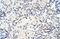 Mitochondrial RRNA Methyltransferase 1 antibody, PA5-41911, Invitrogen Antibodies, Immunohistochemistry frozen image 