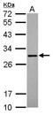 Secretagogin, EF-Hand Calcium Binding Protein antibody, GTX115443, GeneTex, Western Blot image 