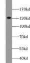 AF4/FMR2 Family Member 1 antibody, FNab00195, FineTest, Western Blot image 