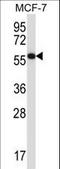 MAPK Associated Protein 1 antibody, LS-C164025, Lifespan Biosciences, Western Blot image 