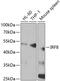 Interferon Regulatory Factor 8 antibody, GTX54312, GeneTex, Western Blot image 