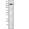 Leucine Rich Repeat Kinase 1 antibody, abx216615, Abbexa, Western Blot image 