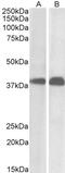 SET Nuclear Proto-Oncogene antibody, PA5-17962, Invitrogen Antibodies, Western Blot image 