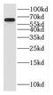 Gamma-Aminobutyric Acid Type A Receptor Alpha4 Subunit antibody, FNab03285, FineTest, Western Blot image 