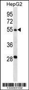 Transmembrane protease serine 13 antibody, 57-905, ProSci, Western Blot image 