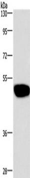 Gamma-Aminobutyric Acid Type A Receptor Alpha1 Subunit antibody, TA351205, Origene, Western Blot image 