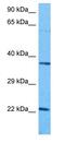 DNA Damage Inducible Transcript 4 Like antibody, GTX45694, GeneTex, Western Blot image 