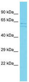 Trimethyllysine Hydroxylase, Epsilon antibody, TA344912, Origene, Western Blot image 