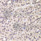 CCNG1 antibody, A7270, ABclonal Technology, Immunohistochemistry paraffin image 