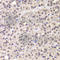 Cyclin-G1 antibody, A7270, ABclonal Technology, Immunohistochemistry paraffin image 