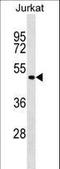 Forkhead Box B2 antibody, LS-C159671, Lifespan Biosciences, Western Blot image 