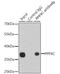 Protein Phosphatase 4 Catalytic Subunit antibody, GTX55756, GeneTex, Immunoprecipitation image 