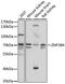 Zinc Finger Protein 384 antibody, 16-348, ProSci, Western Blot image 