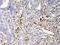 S100 Calcium Binding Protein A7 antibody, A02369-1, Boster Biological Technology, Immunohistochemistry paraffin image 