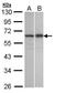 TNFAIP3 Interacting Protein 2 antibody, GTX108962, GeneTex, Western Blot image 