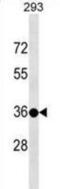 Testis Specific Protein Y-Linked 3 antibody, abx025038, Abbexa, Western Blot image 