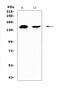 NEDD4 E3 Ubiquitin Protein Ligase antibody, A00984-2, Boster Biological Technology, Western Blot image 