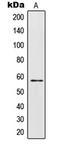 Interferon Lambda Receptor 1 antibody, LS-C353653, Lifespan Biosciences, Western Blot image 