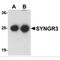 Synaptogyrin 3 antibody, MBS151460, MyBioSource, Western Blot image 