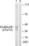 Aurora Kinase B antibody, PA5-38732, Invitrogen Antibodies, Western Blot image 