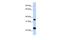 Solute Carrier Family 25 Member 35 antibody, GTX46752, GeneTex, Western Blot image 