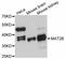 Methionine Adenosyltransferase 2B antibody, A11608, ABclonal Technology, Western Blot image 