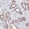 Calcium Binding Protein 39 Like antibody, NBP2-32039, Novus Biologicals, Immunohistochemistry frozen image 