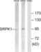 SRSF Protein Kinase 1 antibody, LS-C120371, Lifespan Biosciences, Western Blot image 