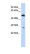 Ring Finger Protein 212 antibody, NBP1-55083, Novus Biologicals, Western Blot image 