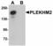 Pleckstrin Homology And RUN Domain Containing M2 antibody, LS-B5051, Lifespan Biosciences, Western Blot image 