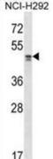 Transcriptional Adaptor 2A antibody, abx028411, Abbexa, Western Blot image 