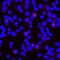 Triggering Receptor Expressed On Myeloid Cells 2 antibody, BAF1828, R&D Systems, Western Blot image 