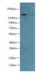 ADAM Metallopeptidase With Thrombospondin Type 1 Motif 7 antibody, A58014-100, Epigentek, Western Blot image 