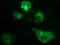 Chorionic somatomammotropin hormone antibody, LS-C788306, Lifespan Biosciences, Immunofluorescence image 