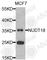 Nudix Hydrolase 18 antibody, A8514, ABclonal Technology, Western Blot image 